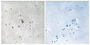 Immunohistochemical analysis of paraffin-embedded human brain using Anti-IGF1R (phospho Tyr1346) Antibody. The right hand panel represents a negative control, where the Antibody was pre-incubated with the immunising peptide