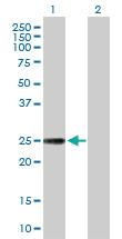 Anti-NXNL1 Rabbit Polyclonal Antibody