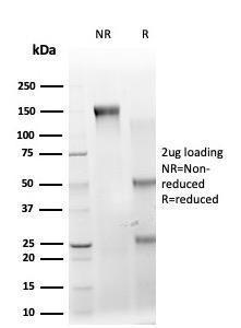 SDS-PAGE analysis of Anti-IRF3 Antibody [PCRP-IRF3-1E6] under non-reduced and reduced conditions; showing intact IgG and intact heavy and light chains, respectively. SDS-PAGE analysis confirms the integrity and purity of the antibody.