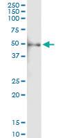 Anti-PHGDH Polyclonal Antibody Pair