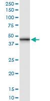 Anti-GALT Polyclonal Antibody Pair