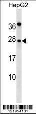 Anti-NOG Rabbit Polyclonal Antibody