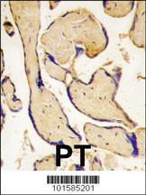 Anti-EPHA3 Rabbit Polyclonal Antibody (HRP (Horseradish Peroxidase))