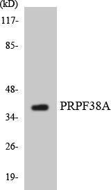 Western blot analysis of the lysates from HUVEC cells using Anti-PRPF38A Antibody