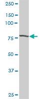 Anti-STAT1 Rabbit Polyclonal Antibody