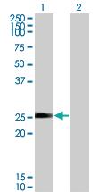 Anti-NXNL1 Mouse Monoclonal Antibody [clone: 7H3]