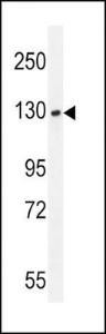 Anti-BUB1 Rabbit Polyclonal Antibody (HRP (Horseradish Peroxidase))