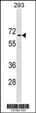 Anti-CCDC151 Rabbit Polyclonal Antibody (AP (Alkaline Phosphatase))