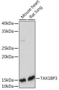 Western blot analysis of extracts of various cell lines, using Anti-TIP-1 Antibody [ARC2319] (A307891) at 1:1,000 dilution. The secondary antibody was Goat Anti-Rabbit IgG H&L Antibody (HRP) at 1:10,000 dilution.