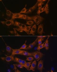 Immunofluorescence analysis of NIH-3T3 cells using Anti-Fatty Acid Synthase Antibody [ARC0377] (A305468) at a dilution of 1:100 (40X lens). DAPI was used to stain the cell nuclei (blue)