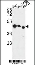 Anti-RDH10 Rabbit Polyclonal Antibody