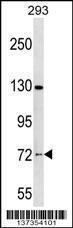 Anti-NOL4 Rabbit Polyclonal Antibody (APC (Allophycocyanin))