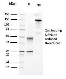 SDS-PAGE analysis of Anti-Parathyroid Hormone Antibody [3H9] under non-reduced and reduced conditions; showing intact IgG and intact heavy and light chains, respectively. SDS-PAGE analysis confirms the integrity and purity of the antibody