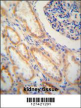 Anti-SHISA2 Rabbit Polyclonal Antibody (AP (Alkaline Phosphatase))