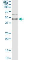 Anti-SPHK1 Antibody Pair