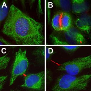 Immunofluorescent analysis of HeLa cells stained with Anti-Aurora B Kinase Antibody (1:1,000/red) and Anti-Vimentin Antibody (A85421/1:10,000/green)