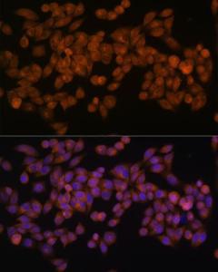 Immunofluorescence analysis of HeLa cells using Anti-Fatty Acid Synthase Antibody [ARC0377] (A305468) at a dilution of 1:100 (40X lens). DAPI was used to stain the cell nuclei (blue)