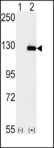 Anti-BUB1B Rabbit Polyclonal Antibody (Biotin)