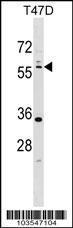 Anti-STK11 Rabbit Polyclonal Antibody (HRP (Horseradish Peroxidase))