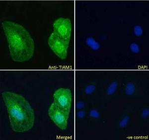 Anti-TIAM1 Antibody (A83986) Immunofluorescence analysis of paraformaldehyde fixed U2OS cells, permeabilized with 0.15% Triton