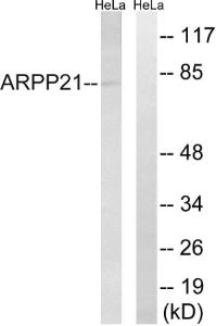 Western blot analysis of lysates from HeLa cells using Anti-ARPP21 Antibody The right hand lane represents a negative control, where the antibody is blocked by the immunising peptide