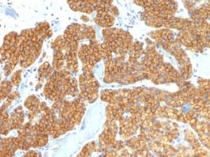 Immunohistochemical analysis of formalin-fixed, paraffin-embedded human parathyroid using Anti-Parathyroid Hormone Antibody [PTH/911]