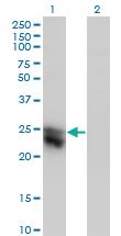 Anti-CTHRC1 Mouse Monoclonal Antibody [clone: 1G12]