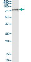 Anti-TPP1 Polyclonal Antibody Pair