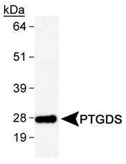 Anti-PTGDS Rabbit Polyclonal Antibody