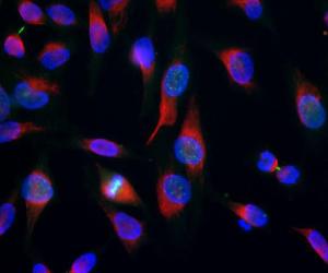 HeLa cell cultures were stained with Anti-Aurora B Kinase Antibody (green) Localization of aurora B is cell cycle phase dependent First, Aurora B staining was seen in chromosome arm in cells in prophase (green small dots)