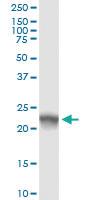 Anti-NOP16 Polyclonal Antibody Pair