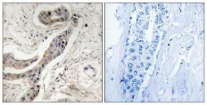 Antibody anti-BCL-XL phospho THR115