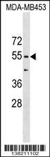 Anti-CORO1B Rabbit Polyclonal Antibody (AP (Alkaline Phosphatase))