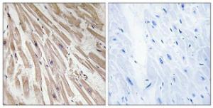 Immunohistochemical analysis of paraffin-embedded human heart tissue using Anti-ARPP21 Antibody The right hand panel represents a negative control, where the antibody was pre-incubated with the immunising peptide