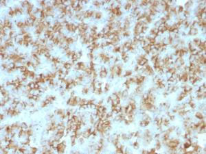 Immunohistochemical analysis of formalin-fixed, paraffin-embedded human parathyroid using Anti-Parathyroid Hormone Antibody [PTH/911]