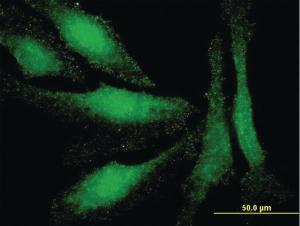 Anti-LMO3 Mouse Monoclonal Antibody [clone: 4C4]