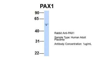 Anti-PAX1 Rabbit Polyclonal Antibody