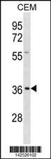 Anti-EFNB1 Rabbit Polyclonal Antibody (FITC (Fluorescein Isothiocyanate))