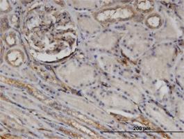 Anti-CTHRC1 Mouse Monoclonal Antibody [clone: 1G12]