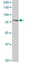 Anti-DTX3L Mouse Monoclonal Antibody [clone: 1D10]