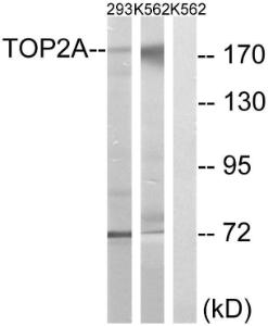 Western blot analysis of lysates from K562 and 293 cells using Anti-TOP2A Antibody. The right hand lane represents a negative control, where the Antibody is blocked by the immunising peptide