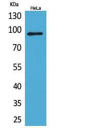 Western blot analysis of extracts from HeLa cells using Anti-ITGB2 Antibody