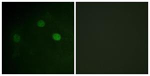 Immunofluorescence analysis of COS7 cells using Anti-CDK1 (phospho Thr14) Antibody. The right hand panel represents a negative control, where the antibody was pre-incubated with the immunising peptide.