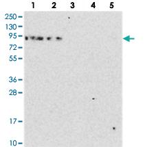 Anti-DDX51 Rabbit Polyclonal Antibody