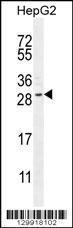 Anti-CCDC153 Rabbit Polyclonal Antibody (AP (Alkaline Phosphatase))