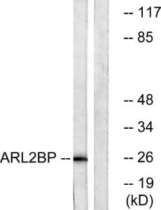 Antibody anti-ARL2BP A96961-100 100 µg