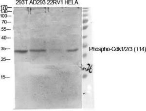 Western blot analysis of various cells using Anti-CDK1 (phospho Thr14) Antibody