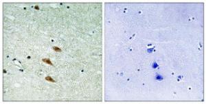 Immunohistochemical analysis of paraffin-embedded human brain tissue using Anti-TOP2A Antibody. The right hand panel represents a negative control, where the Antibody was pre-incubated with the immunising peptide