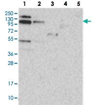 Anti-RBM15B Rabbit Polyclonal Antibody