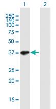 Anti-SGOL1 Mouse Polyclonal Antibody